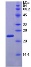 Recombinant Ribonuclease P (RNASEP)