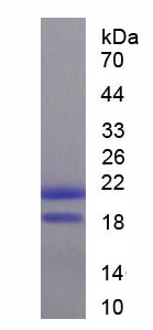 Recombinant Fatty Acid Binding Protein 9, Testis (FABP9)