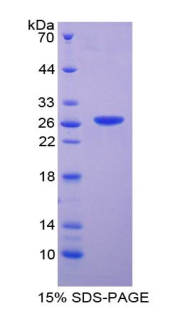 Recombinant Deoxyribonuclease I Like Protein 2 (DNASE1L2)