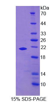 Recombinant Growth Arrest Specific Protein 6 (GAS6)