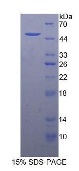 Recombinant Growth Arrest Specific Protein 6 (GAS6)