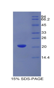 Recombinant Growth Arrest Specific Protein 6 (GAS6)