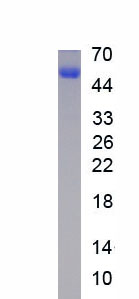 Recombinant Growth Arrest Specific Protein 6 (GAS6)