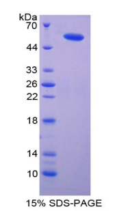 Recombinant Importin 8 (IPO8)
