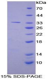 Recombinant Alanine Aminotransferase (ALT)