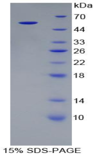 Recombinant Alanine Aminotransferase (ALT)