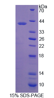 RPA212Hu01.jpg