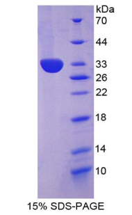 Recombinant Collagen Type I Alpha 2 (COL1a2)