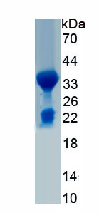 Recombinant Transforming Growth Factor Beta 2 (TGFb2)