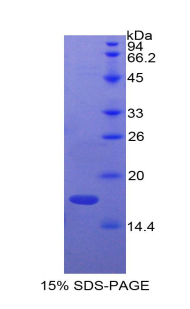 Recombinant Adrenomedullin (ADM)