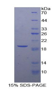 Recombinant Adrenomedullin (ADM)