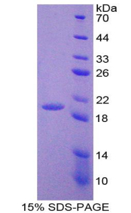 Recombinant Adrenomedullin (ADM)