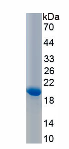 Recombinant Adrenomedullin (ADM)