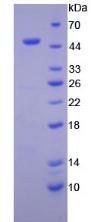 Recombinant Interferon Beta (IFNb)