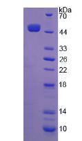 Recombinant Interferon Beta (IFNb)