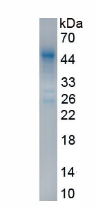 Recombinant Interferon Beta (IFNb)