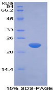 Recombinant Interferon Beta (IFNb)