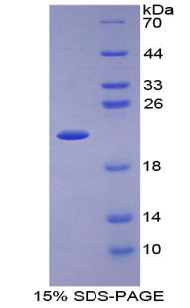 Recombinant Interleukin 1 Receptor Antagonist (IL1RA)