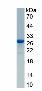 Recombinant Matrix Metalloproteinase 11 (MMP11)