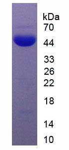 Recombinant Anti-Mullerian Hormone (AMH)