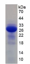 Recombinant Interleukin 2 Receptor Beta (IL2Rb)