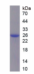 Recombinant Protease, Serine 1 (PRSS1)