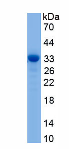 Recombinant Protease, Serine 1 (PRSS1)