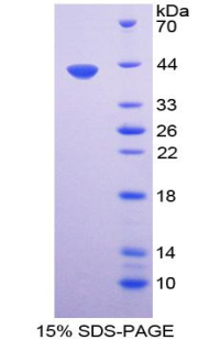 Recombinant Urocortin (UCN)