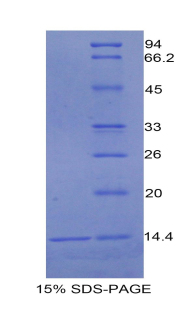 Recombinant Urocortin (UCN)