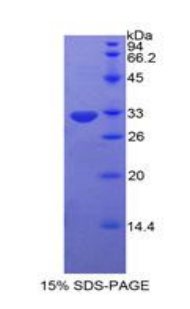 Recombinant Protein Kinase C Eta (PKCh)