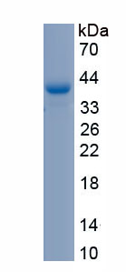 Recombinant Tyrosinase (TYR)