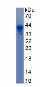 Recombinant Tyrosinase (TYR)