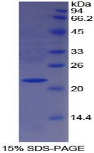 Recombinant Paraoxonase 1 (PON1)