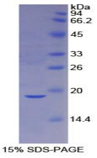 Recombinant Caspase 2 (CASP2)