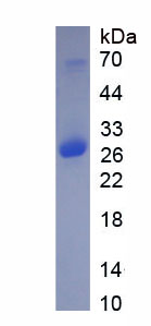 Recombinant Trypsin (TRY)