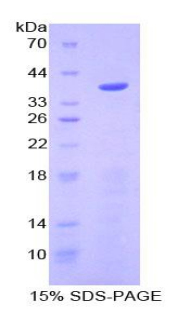 Recombinant Apolipoprotein C1 (APOC1)