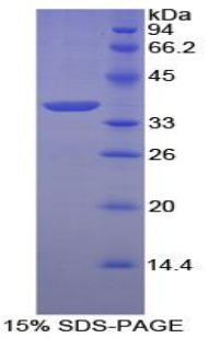 Recombinant Annexin V (ANXA5)