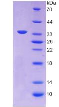 Recombinant Annexin V (ANXA5)