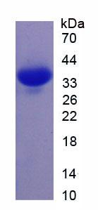 Recombinant Annexin V (ANXA5)