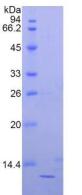 Recombinant Beta-2-Microglobulin (b2M)