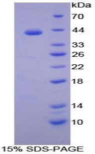 Recombinant Transferrin Receptor 2 (TFR2)