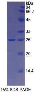 Recombinant Transferrin Receptor 2 (TFR2)