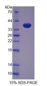 Recombinant Transferrin Receptor 2 (TFR2)