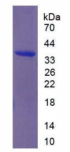 Recombinant Transferrin Receptor 2 (TFR2)