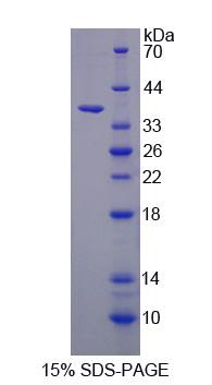 Recombinant Transferrin Receptor 2 (TFR2)