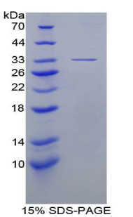 Recombinant Cathepsin K (CTSK)