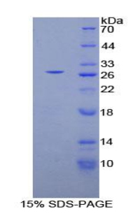 Recombinant Phospholipase C Gamma 1 (PLCg1)