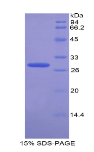 Recombinant Transportin 1 (TNPO1)