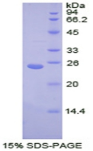 Recombinant Transportin 1 (TNPO1)