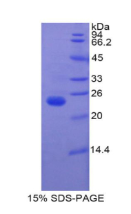 Recombinant Insulin Like Growth Factor Binding Protein 6 (IGFBP6)